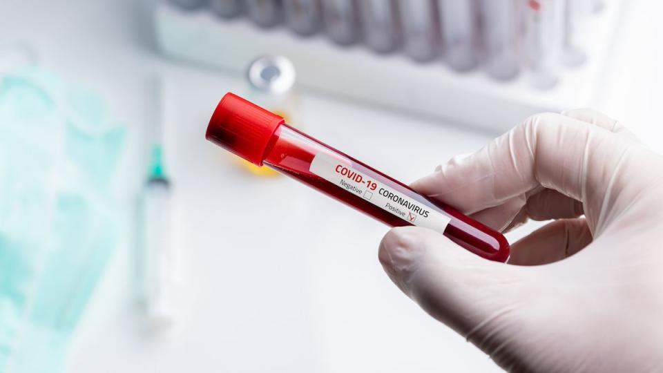 În raionul Cahul a fost înregistrat primul infectat cu Coronavirus