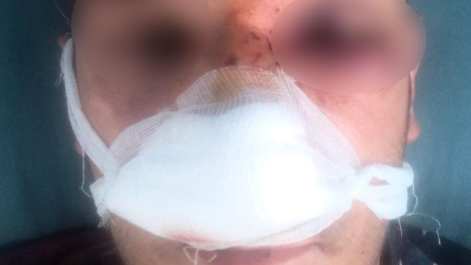 Un tată și fiu din Cahul au fost agresați în trafic de 4 bărbați originari din Ciadîr-Lunga. Află motivul