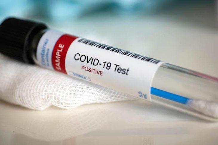 Numărul infectărilor COVID-19 a scăzut, dar crește numărul cazurilor grave