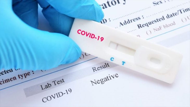 Instituțiile medico-sanitare publice din țară au primit teste rapide pentru detectarea COVID-19