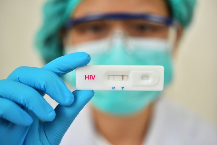 Peste 17 mii de moldoveni suferă de HIV