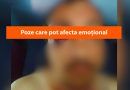 Un bărbat din Leova susține că ar fi fost agresat și jefuit în stradă. Poze care pot afecta emoțional