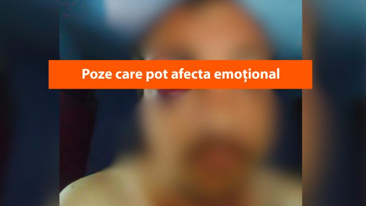 Un bărbat din Leova susține că ar fi fost agresat și jefuit în stradă. Poze care pot afecta emoțional