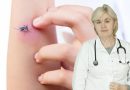 Atenție la înțepăturile de insecte. Sfatul medicului alergolog, Tatiana Gorelco