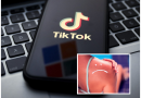 Noul trend viral de pe TikTok care poate crește riscul de cancer de piele