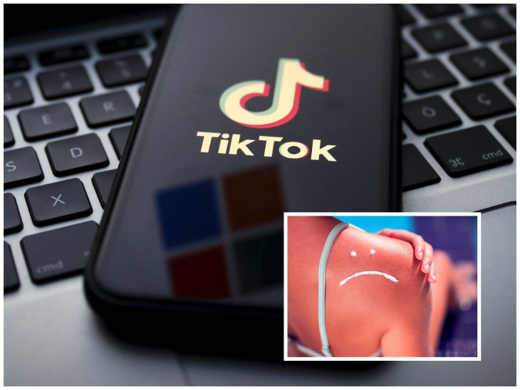 Noul trend viral de pe TikTok care poate crește riscul de cancer de piele